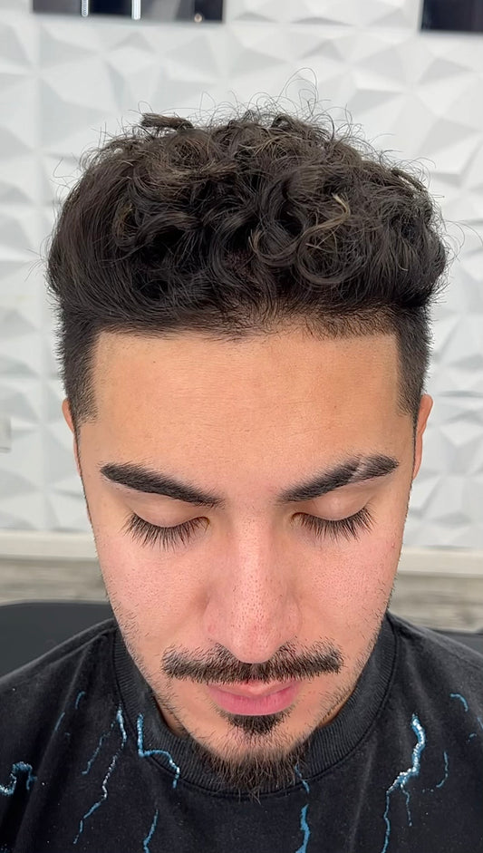 Front Hairline SMP